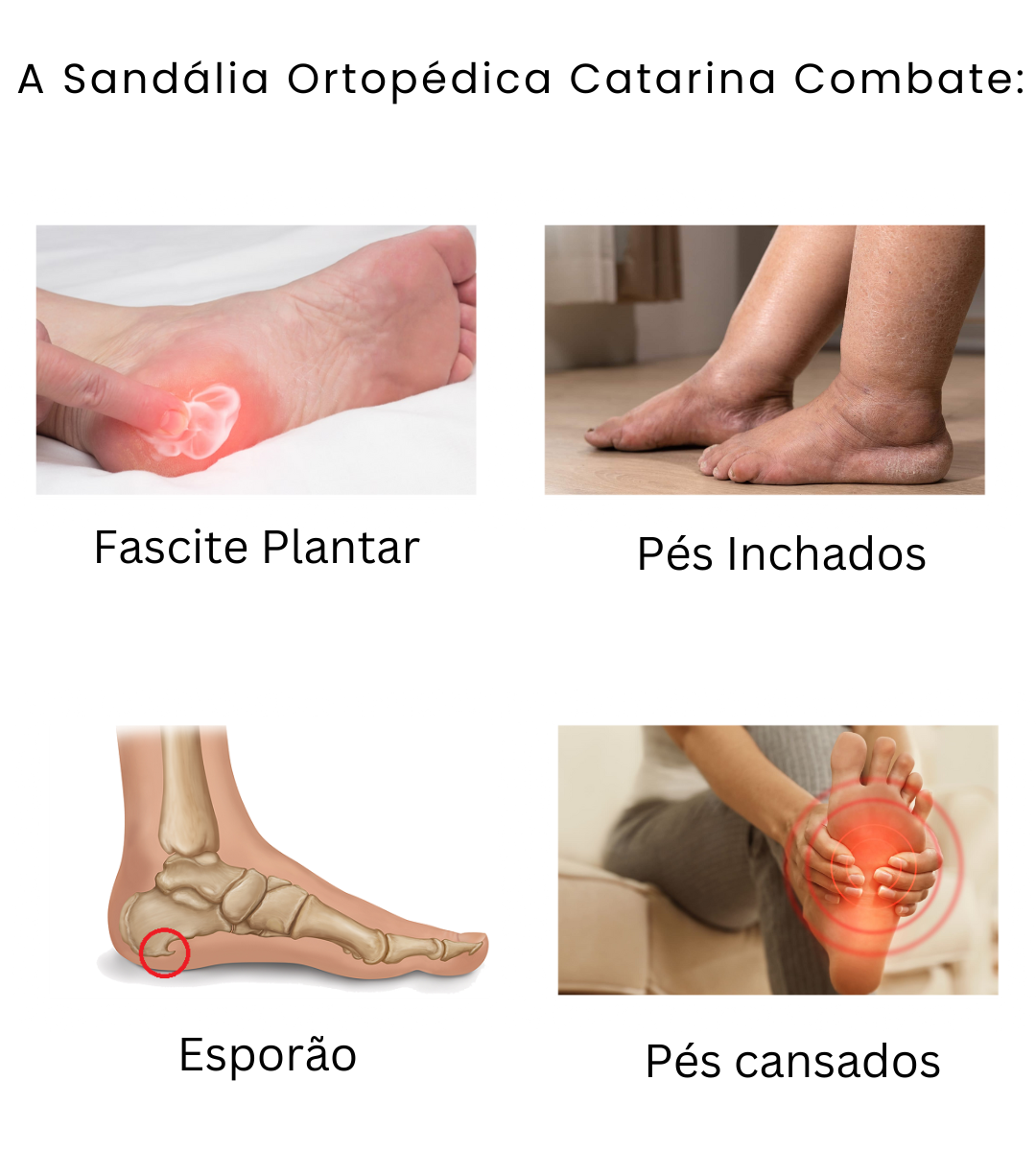 Sandália Ortopédica Catarina + Sandália Papete Brilhante Luxo 2 em 1 Grátis